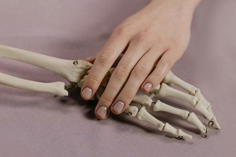 Beyond Milk: The Real Factors Behind Osteoporosis